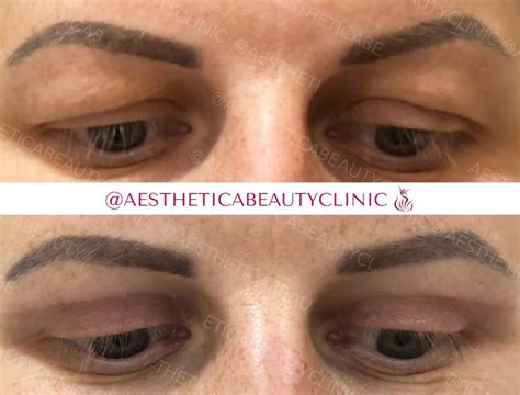 estetica lv|aesthetica lv.